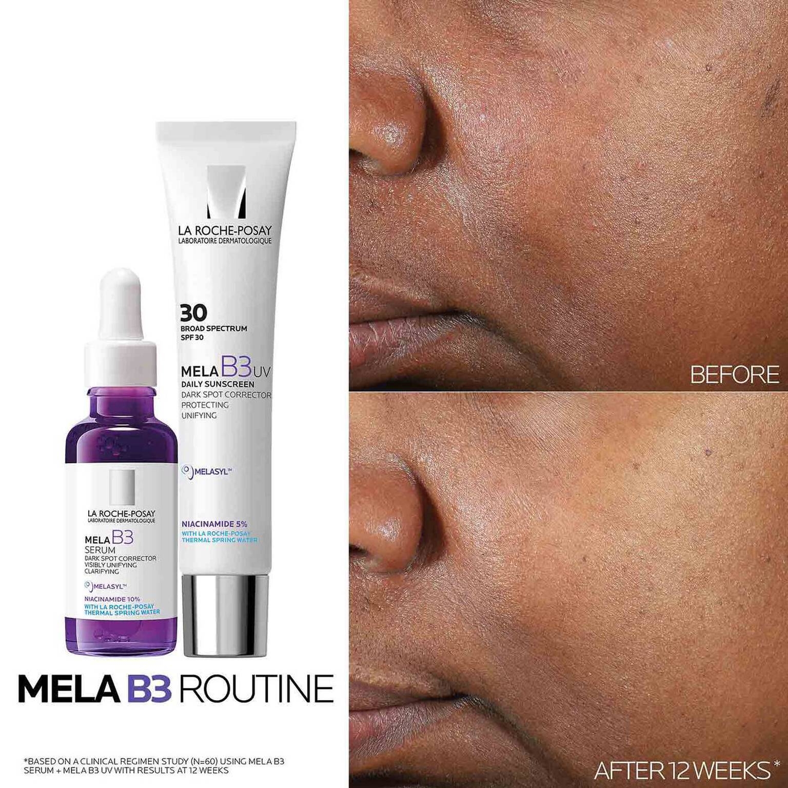 mela-b3-dark-spot-serum-and-mela-b3-uv-daily-moisturizer-with-spf-30-l4 3-Mela-B3-routine_1500X1500.jpg
