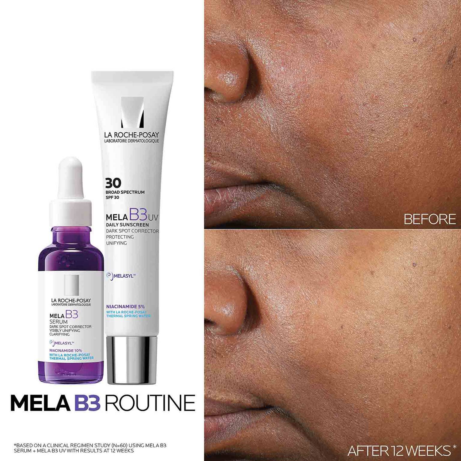 mela-b3-dark-spot-serum-with-melasyltm-niacinamide-w1 Mela-B3-routine_1500X1500.jpg